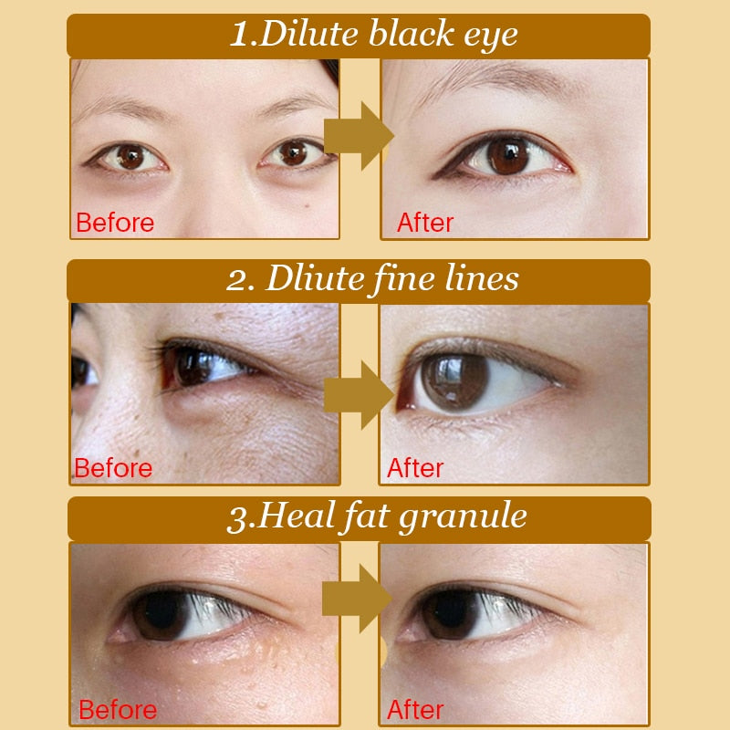 10pcs=5pair Black Collagen Eye Mask Crystal Eyelid Patch Anti Wrinkle Moisture