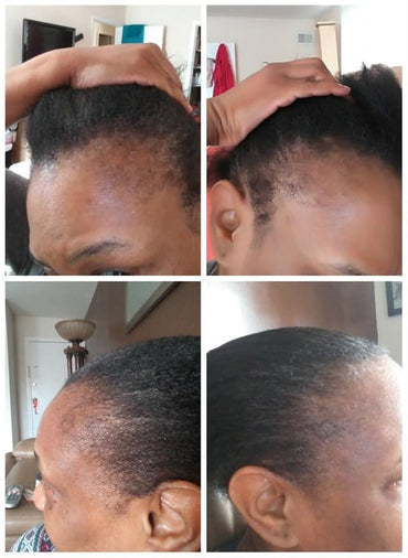 Kreyol Essence - Rosemary Peppermint Haitian Black Castor Oil for Skin and Hair, 3.4 Oz Glass Bottle -, Natural Humectant, Hair Growth.