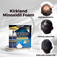 KIRKLAND Minoxidil Topical Aerosol 5% Foam - Minoxidil For Men Hair Loss Regrowth Treatment - Monoxide for Men Hair - 2.11oz