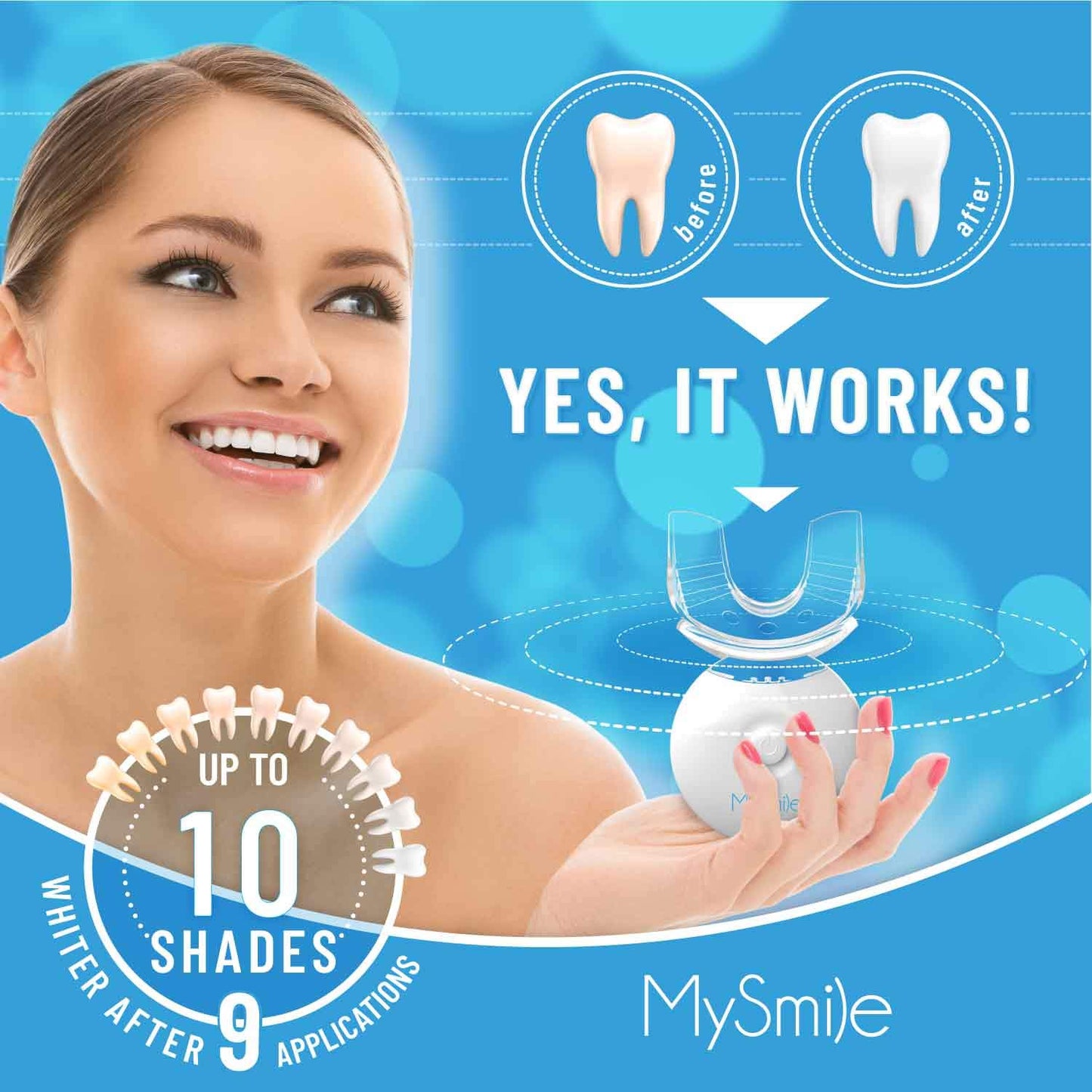 MySmile Teeth Whitening Kit with LED Light, 10 Min Non-Sensitive Fast Teeth Whitener with 3 Carbamide Peroxide Teeth Whitening Gel, Helps to Remove Stains from Coffee, Smoking, Wines, Soda, Food